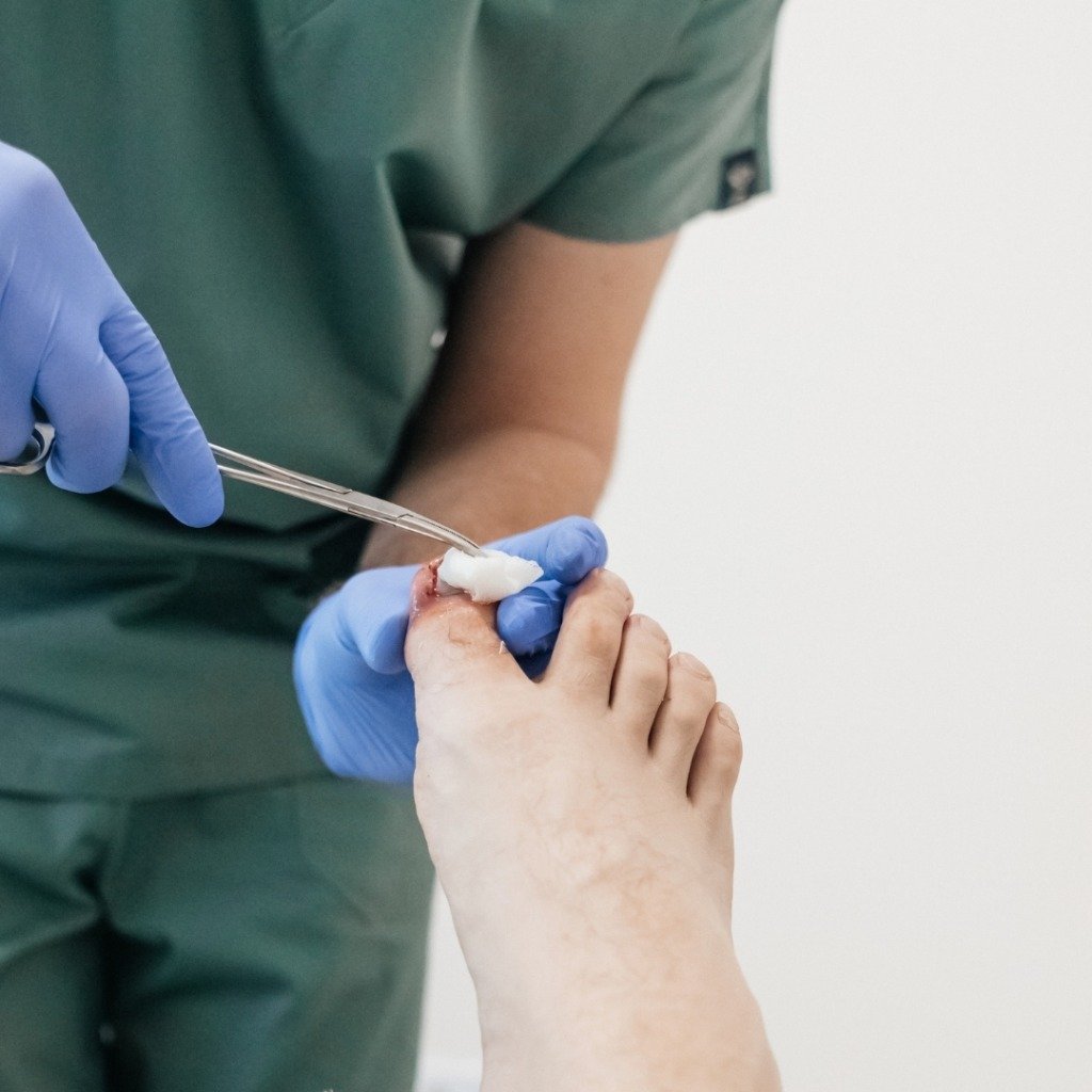 Nail Surgery & Matrixectomy